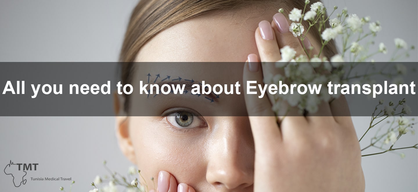 All you need toknow-about Eyebrow transplant