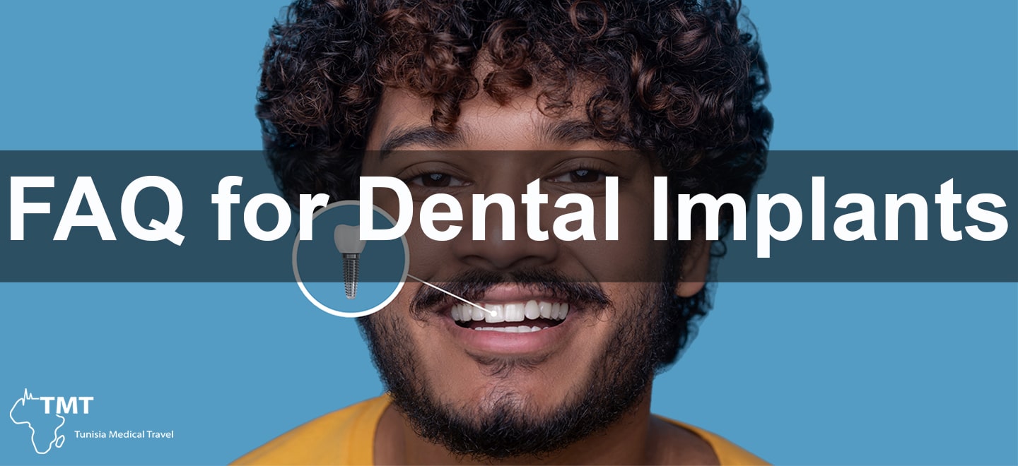 FAQ for Dental Implants