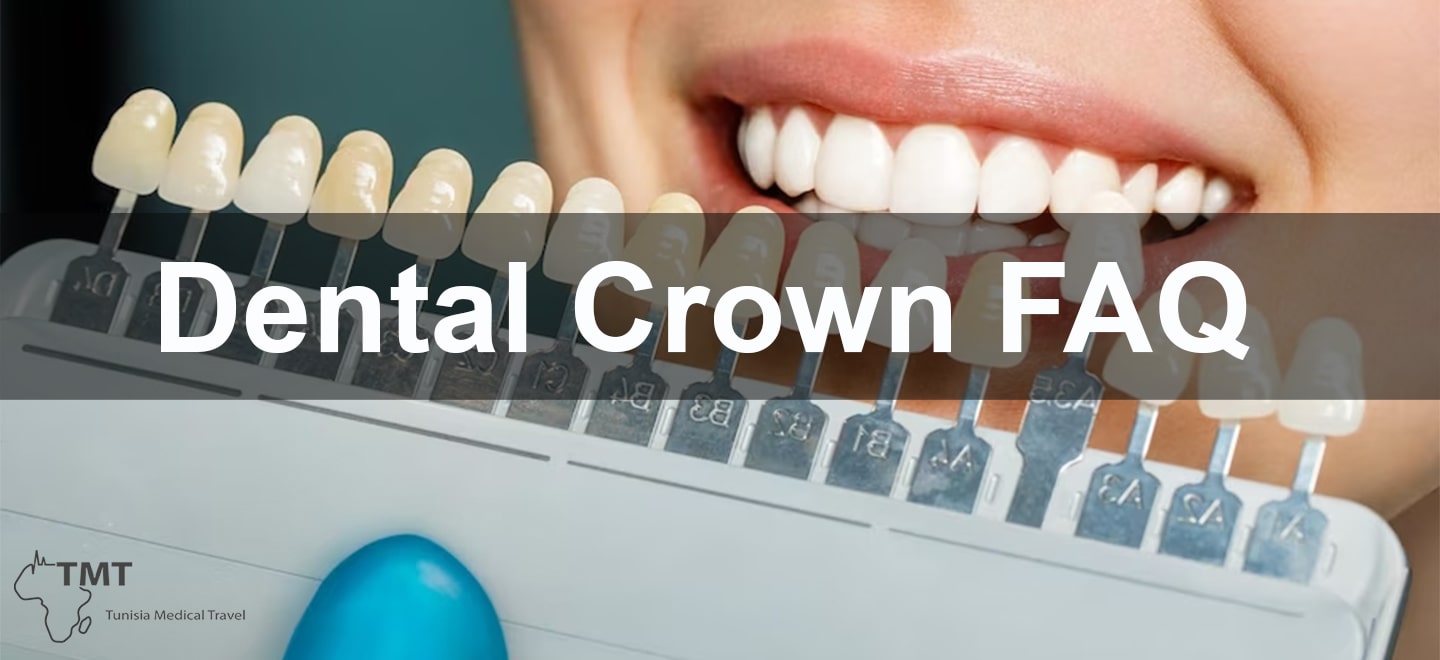Dental Crown FAQ