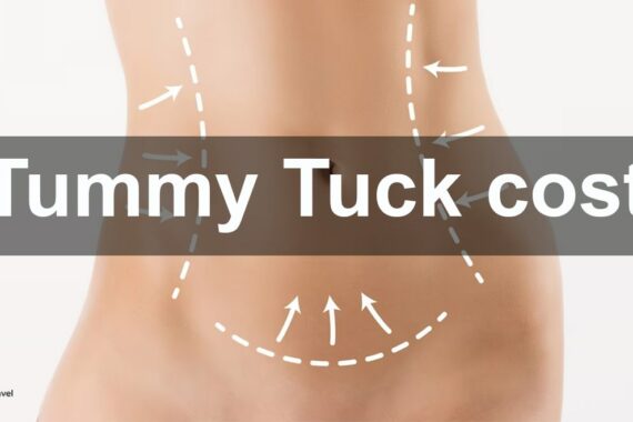 Tummy Tuck cost