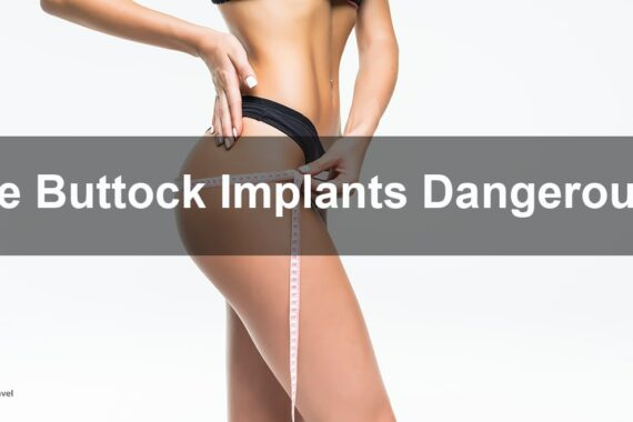 Buttock Implants