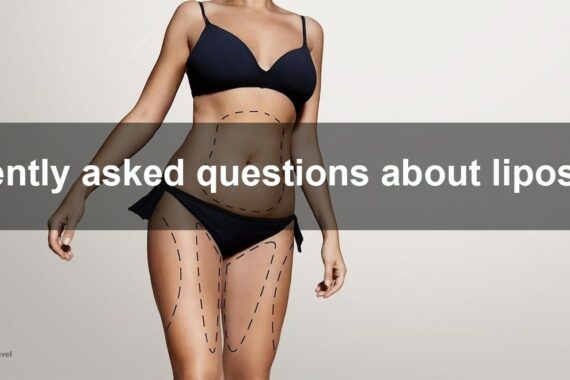 Liposuction questions