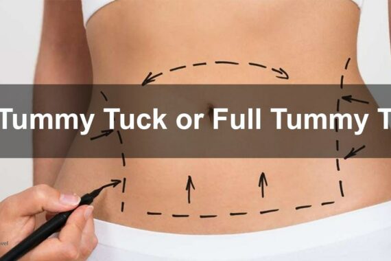 Tummy tuck surgery