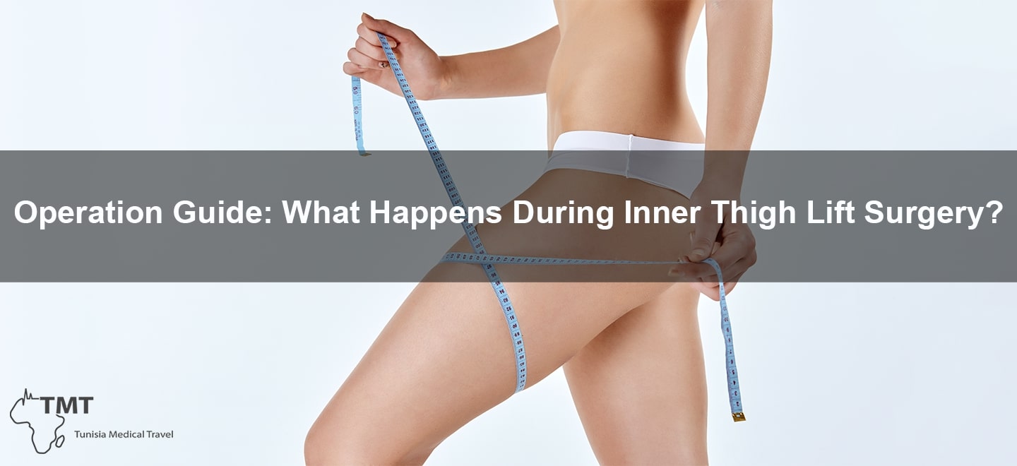 Recovering from Inner Thigh Lift 