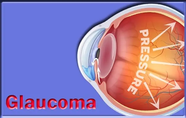 Glaucoma medication