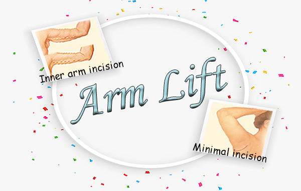 Arm Lift FAQs