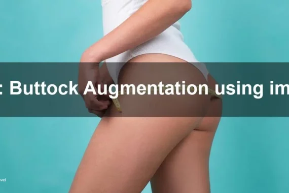 A buttock augmentation