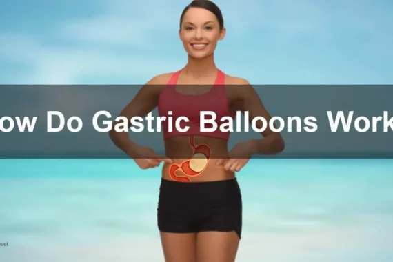 Gastric Balloons
