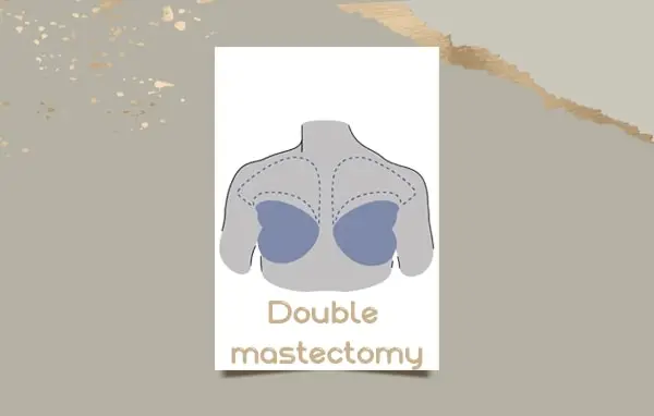 Double Mastectomy