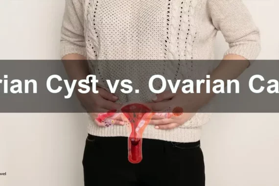 Ovarian Cysts vs. Cancer