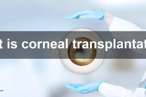 Corneal transplantation