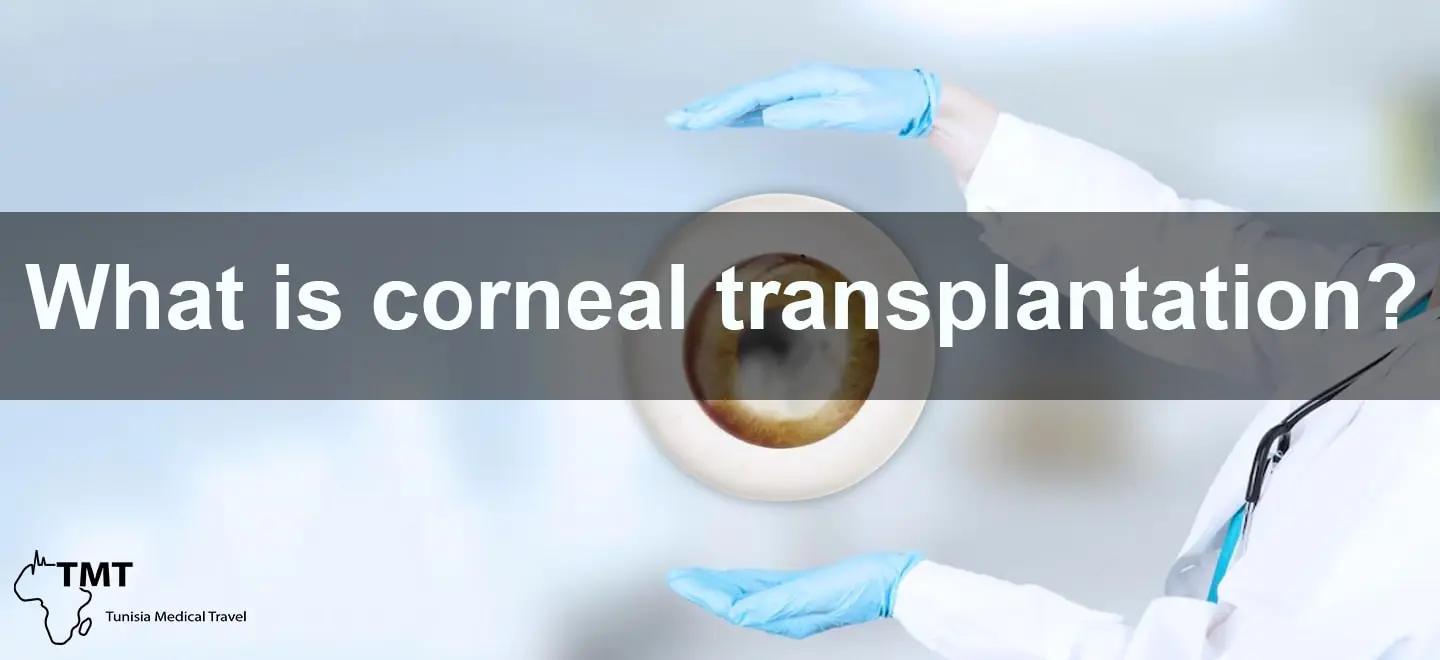 Corneal transplantation