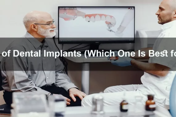 A dental implants