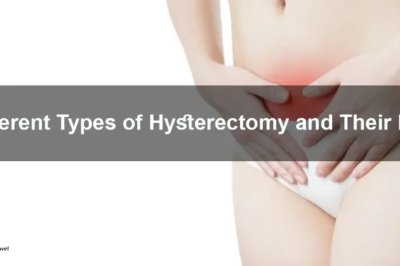 A hysterectomy